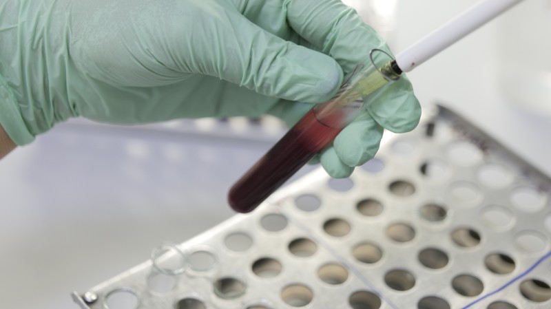 В Карабудахкентском районе проводятся мероприятия по подготовке поголовья к перегону